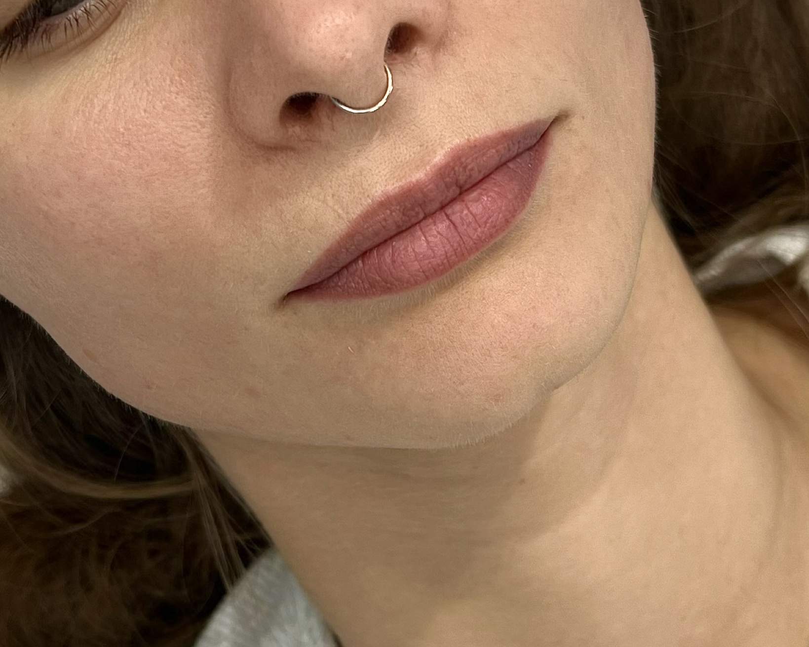 До процедуры Контурная пластика губ