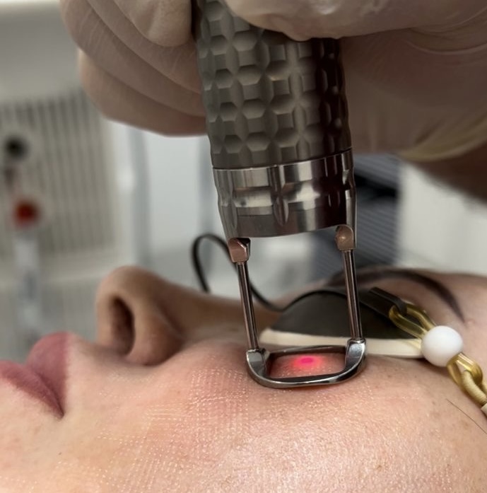 Лечение рубцов